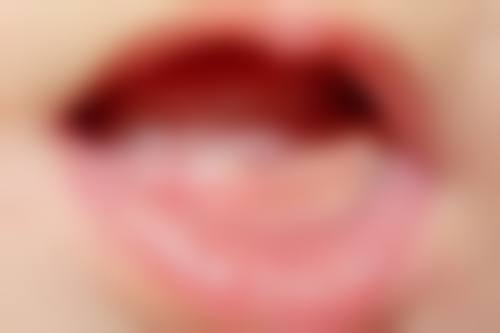 蚌埠儿童齿科医生24小时在线咨询，公立私立资源可选，解答孩子各类口腔问题