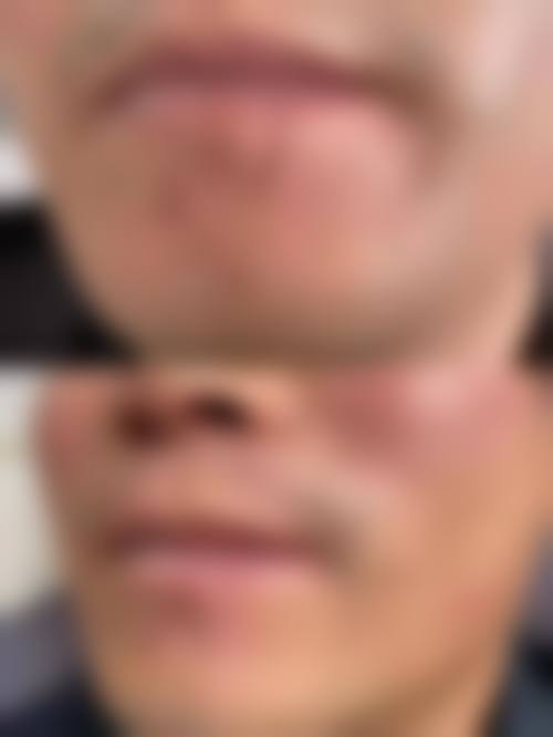 陈怡皆医生口碑评价