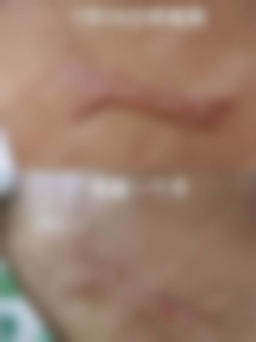 陈怡皆医生技术优势