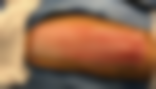 六、厦门左语整形医院口碑怎么样?