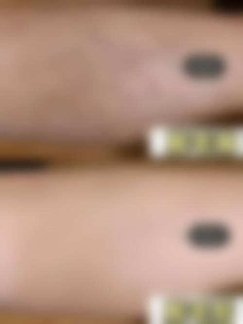 五、厦门左语整形医院收费价格表