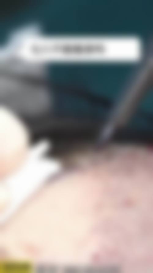 六、湖北孝感芯薇整形医院口碑怎么样？