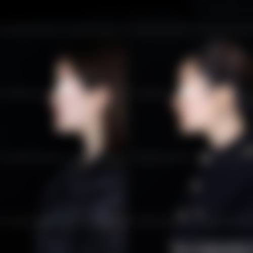 二、山东菏泽悦美整形医院是正规医院吗？