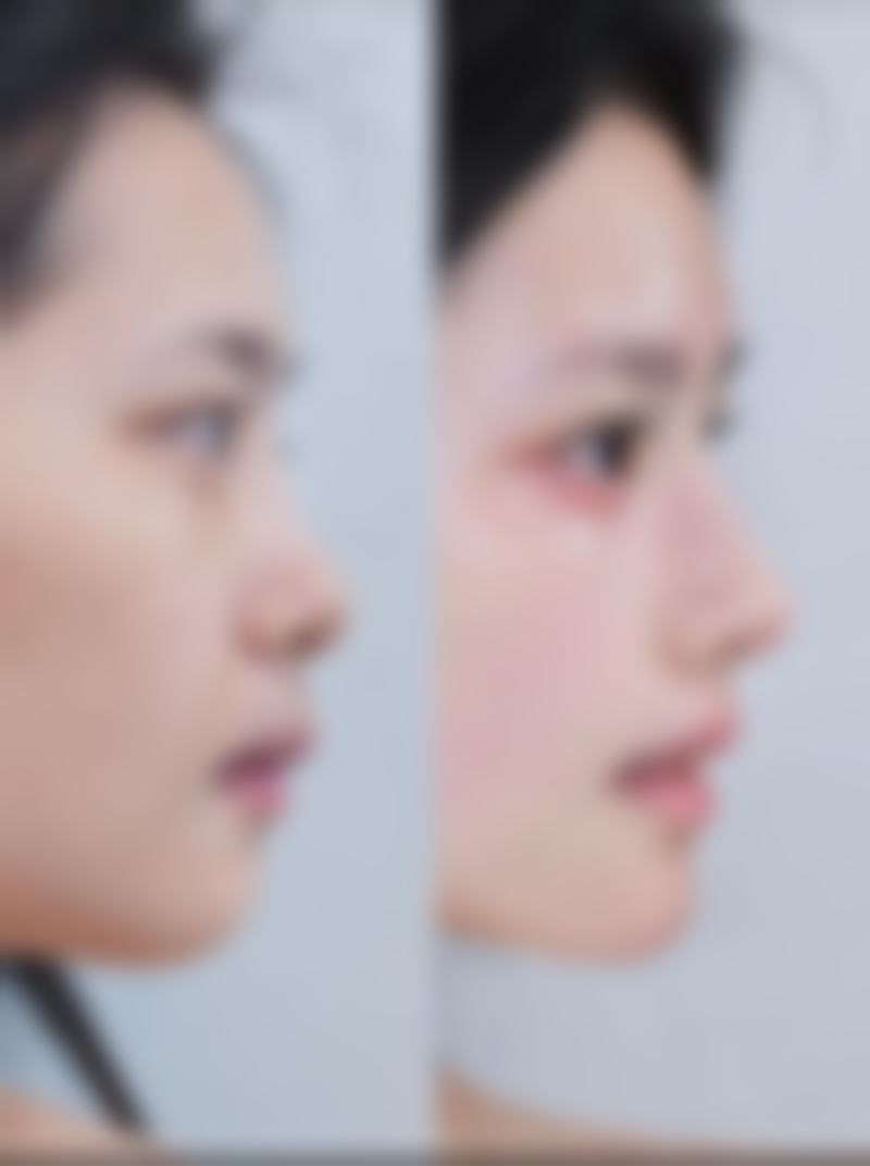 三、长沙朱小平整形医疗美容门诊部特色项目及技术优势