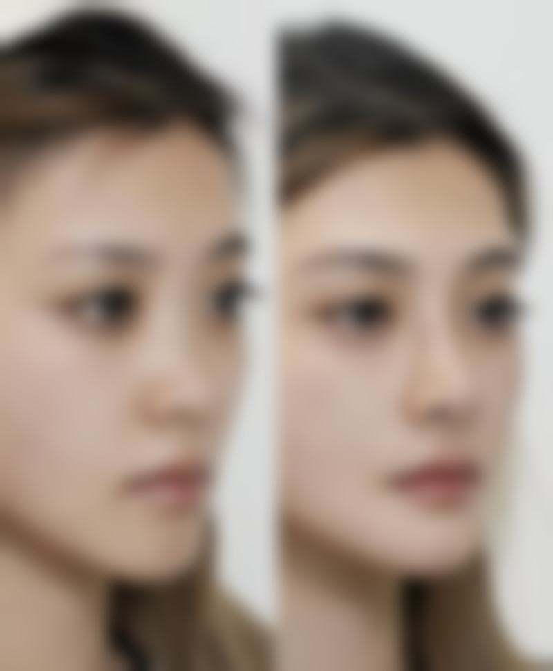 六、韩国TheClass&美自人医院收费价格表