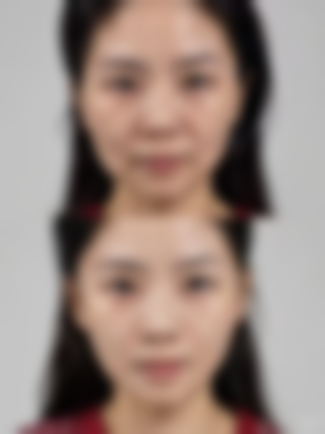 七、韩国TheClass&美自人医院口碑怎么样？