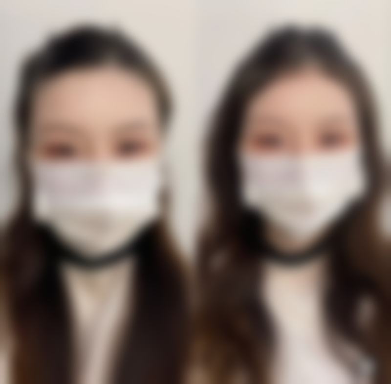 马越医生擅长项目