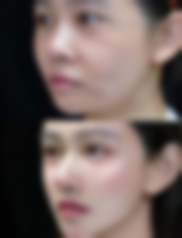 四、郑州艺美千嘉延丽美容整形医院特色项目及技术优势