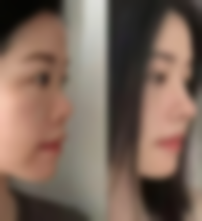 七、泉州薇琳凯医疗美容门诊部口碑怎么样?