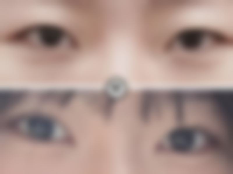 七、韩国德汉斯整形医院口碑怎么样？