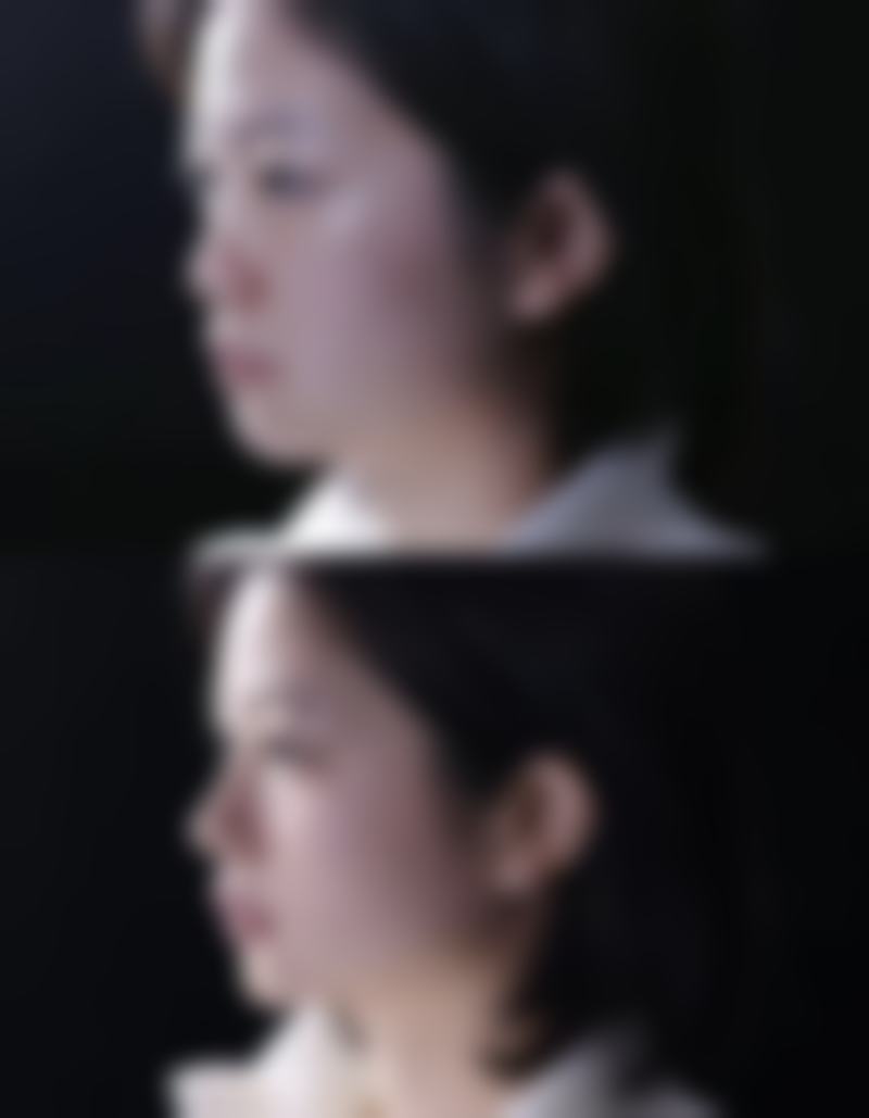 二、济宁华悦整形医院是正规医院吗？