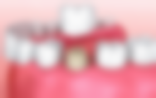 口腔卫生:细致清洁,巩固洗牙成效