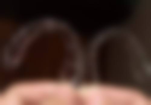 25岁矫正牙齿要多久？这些因素影响大！