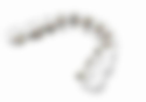 矫正价格揭秘：影响费用的因素有哪些