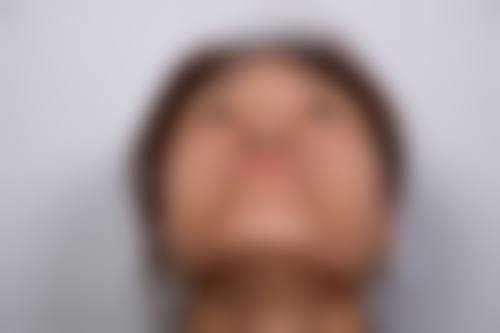 扈明轩院长收费价格表