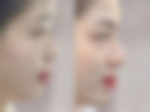 三、北京水研社(新美丽邦)医疗美容诊所特色项目及技术优势