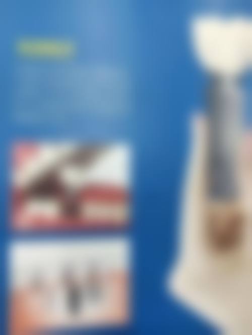 连桥修复：价格与选择