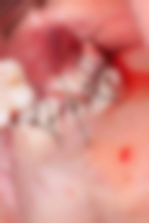 其他优质种植牙医院