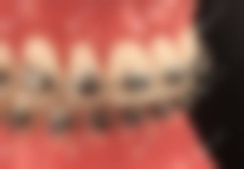 2026越秀区口腔项目收费参考