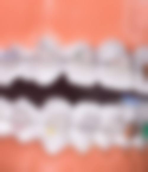 淄博矫正牙较好的医院