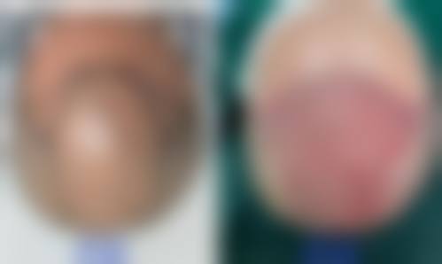 六、佛山雍禾美度医疗美容诊所口碑怎么样