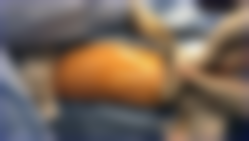 七、福州隆美尔医疗美容门诊部口碑怎么样？