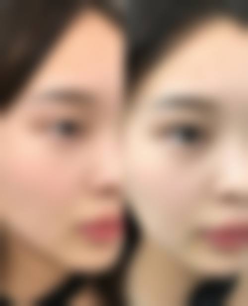 钱鋆医生真人实例