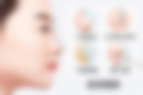 钱鋆医生擅长项目