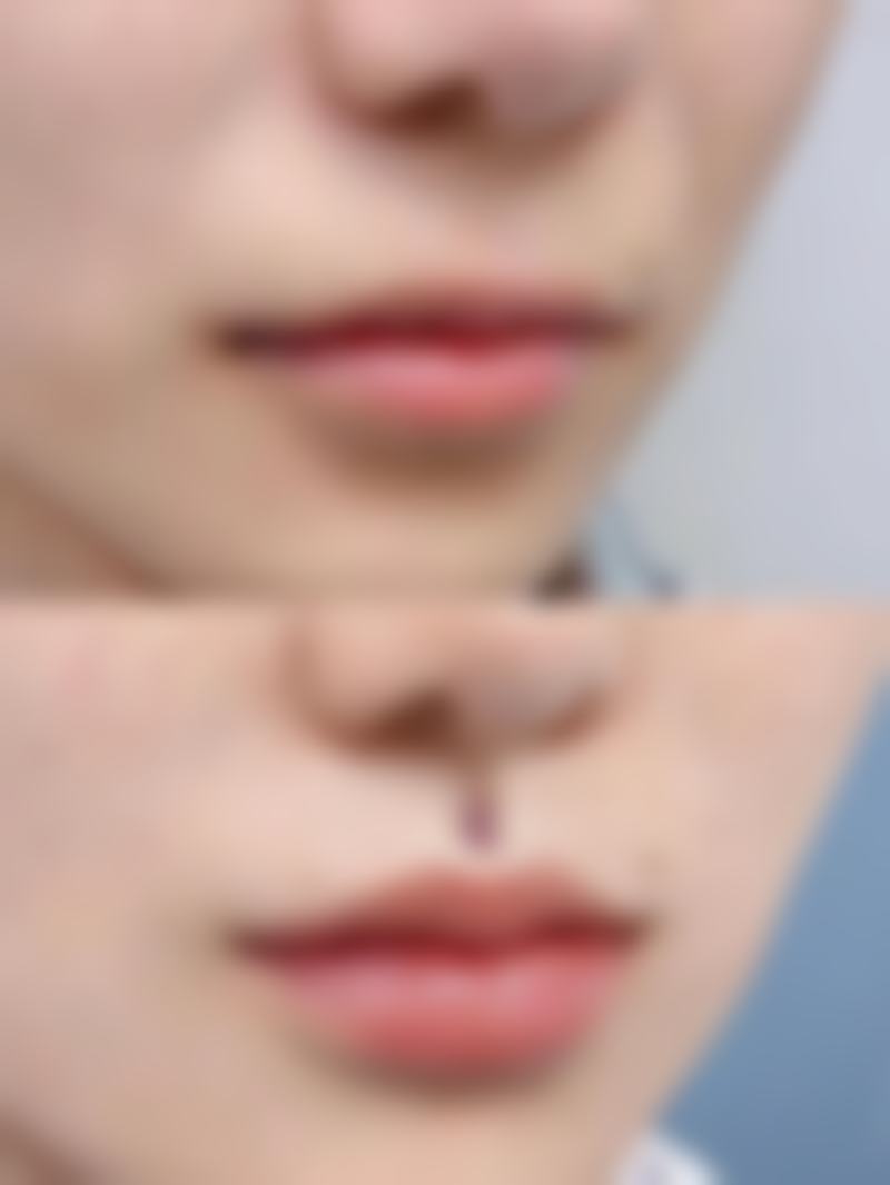 二、广州贝熙医疗美容门诊部是正规医院吗？