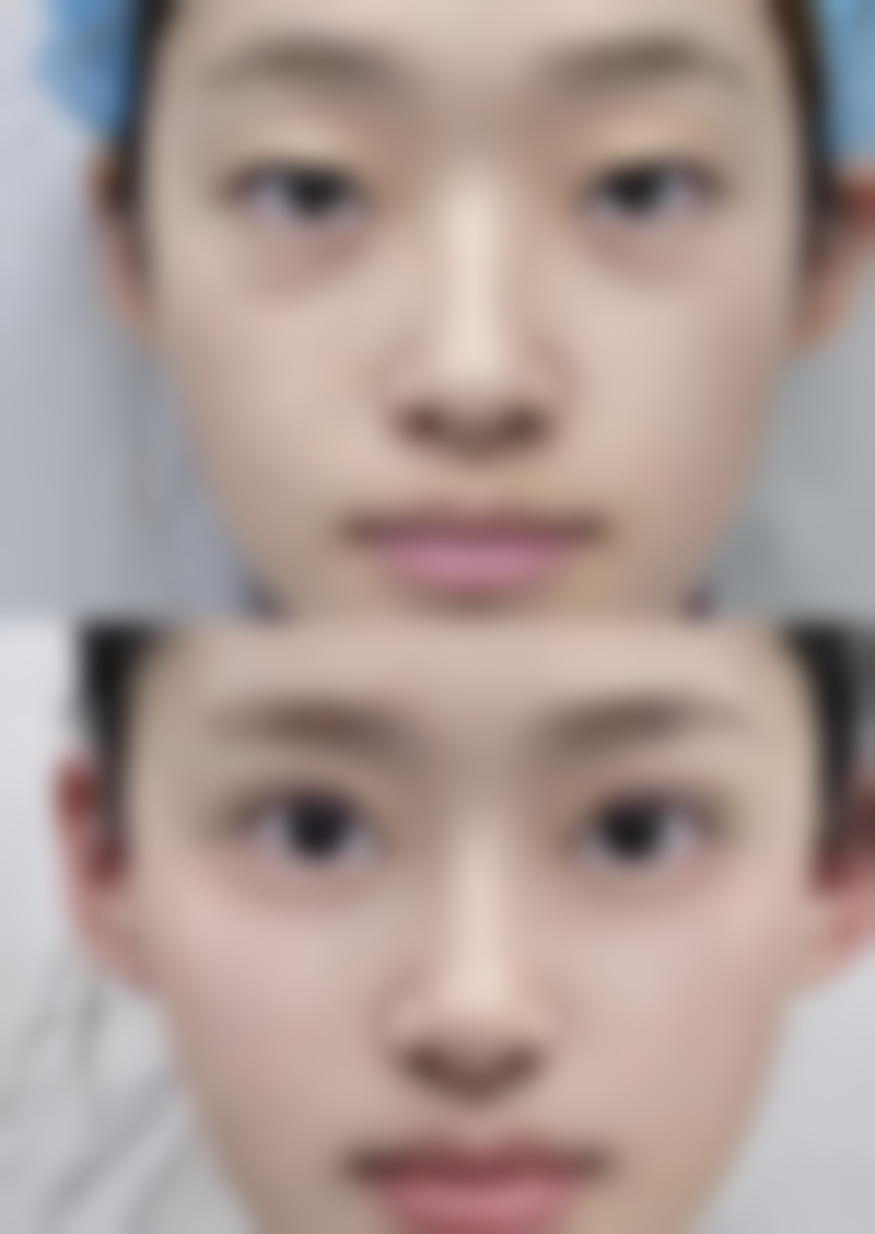 舒婷医生预约挂号