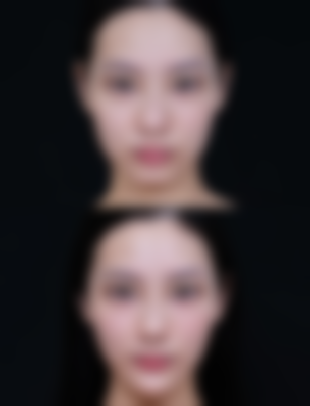 五、韩国乐于丽颜lovely yan整形外科医生简介