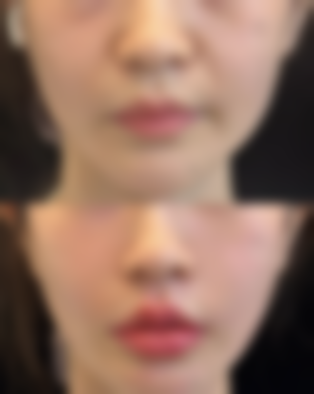 五、佛山雍禾美度医疗美容诊所收费价格表