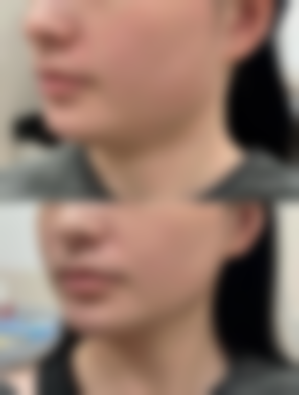 七、韩国乐于丽颜lovely yan整形外科口碑怎么样？