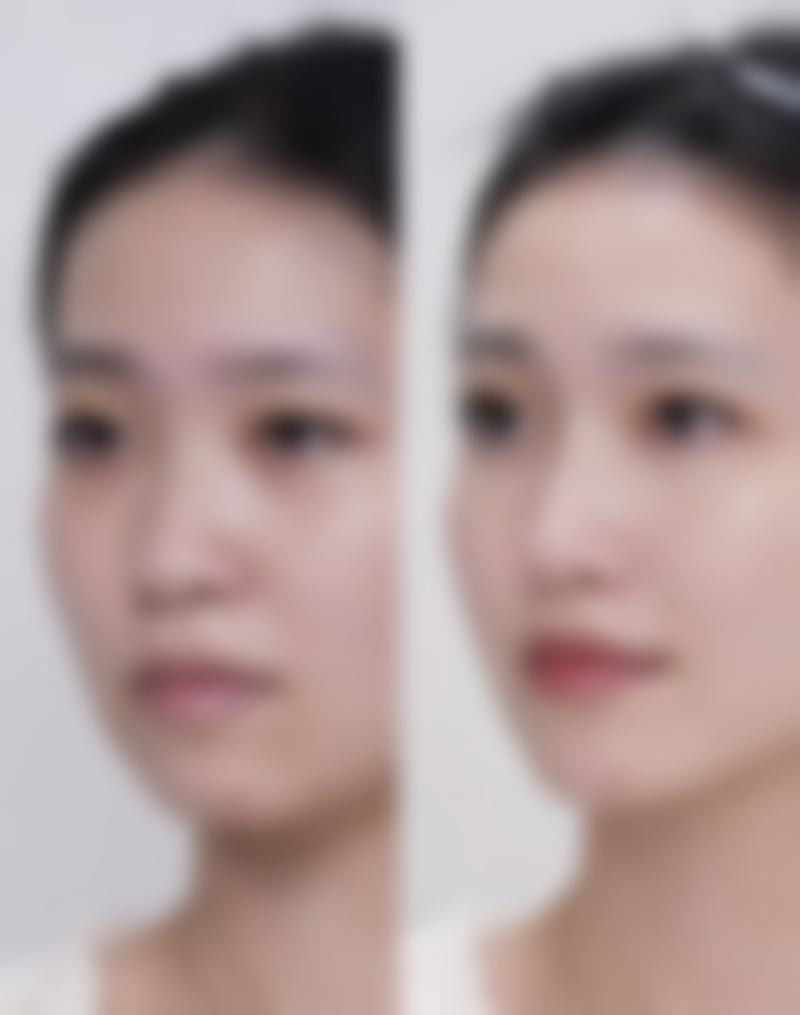 二、福州隆美尔医疗美容门诊部是正规医院吗？