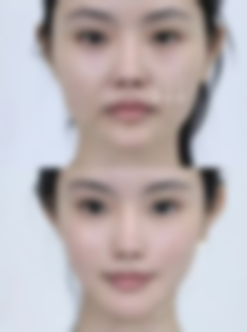 陈怡皆医生真人实例