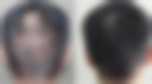 二、贵阳蝶变医疗美容医院是正规医院吗?