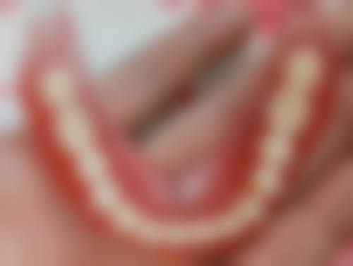 生物相容性：哪种烤瓷牙对口腔更友好