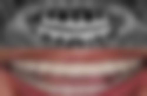 价格大对比：经济成本的考量