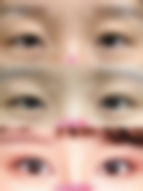 七、昆明博美整形美容医院口碑怎么样？