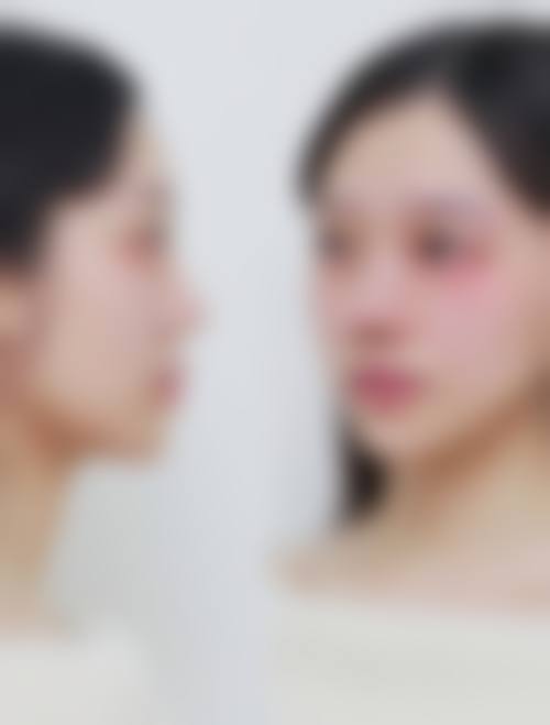 王永祥医生技术优势