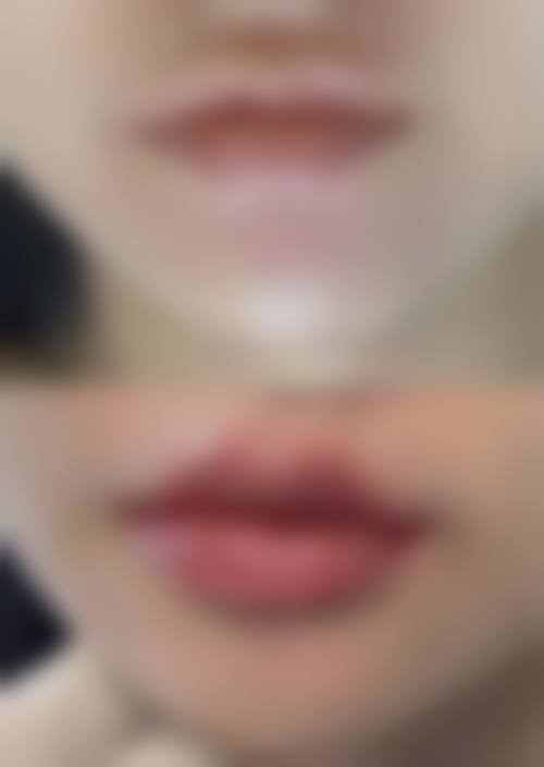 易培金医生擅长项目