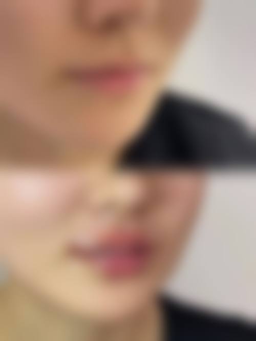 易培金医生真人实例