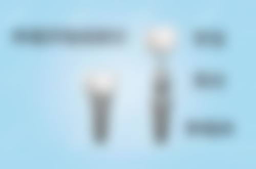 日照博恩口腔：数字化口腔诊疗