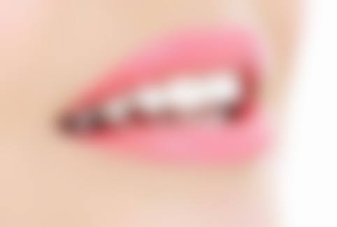 洗牙能洗出哪些牙缝里的“脏东西”？