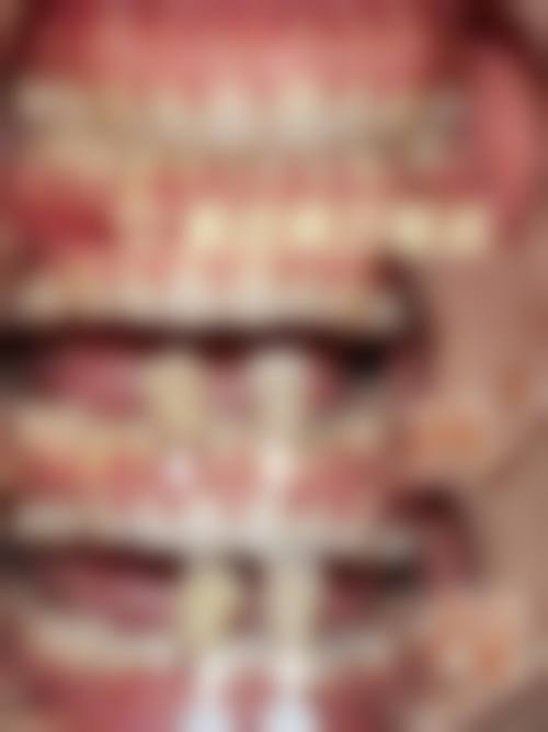 (七)根管治疗项目