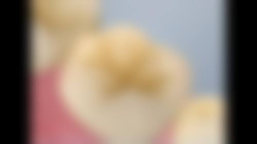 (六)牙齿美白与护理项目