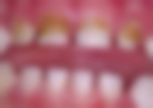 {揭阳儿童齿科医生24小时在线咨询，专业解决乳牙滞留、双排牙等儿童牙难题