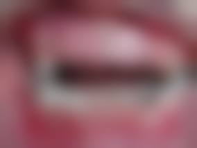 {湖州儿童牙科医生在线咨询24小时，贴心解答娃龋齿、双排牙等儿童牙病难题