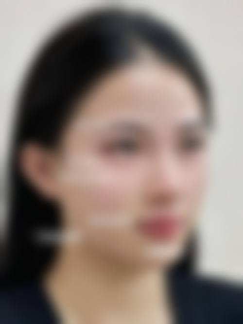 二、义乌市德尔美客整形医疗美容门诊是正规医院吗？