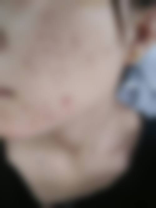 四、ewha皮肤科特色项目及技术优势